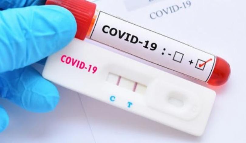 Em sete dias, Sapezal registra aumento de 25% em novos casos de Covid-19; 9 pessoas já morreram