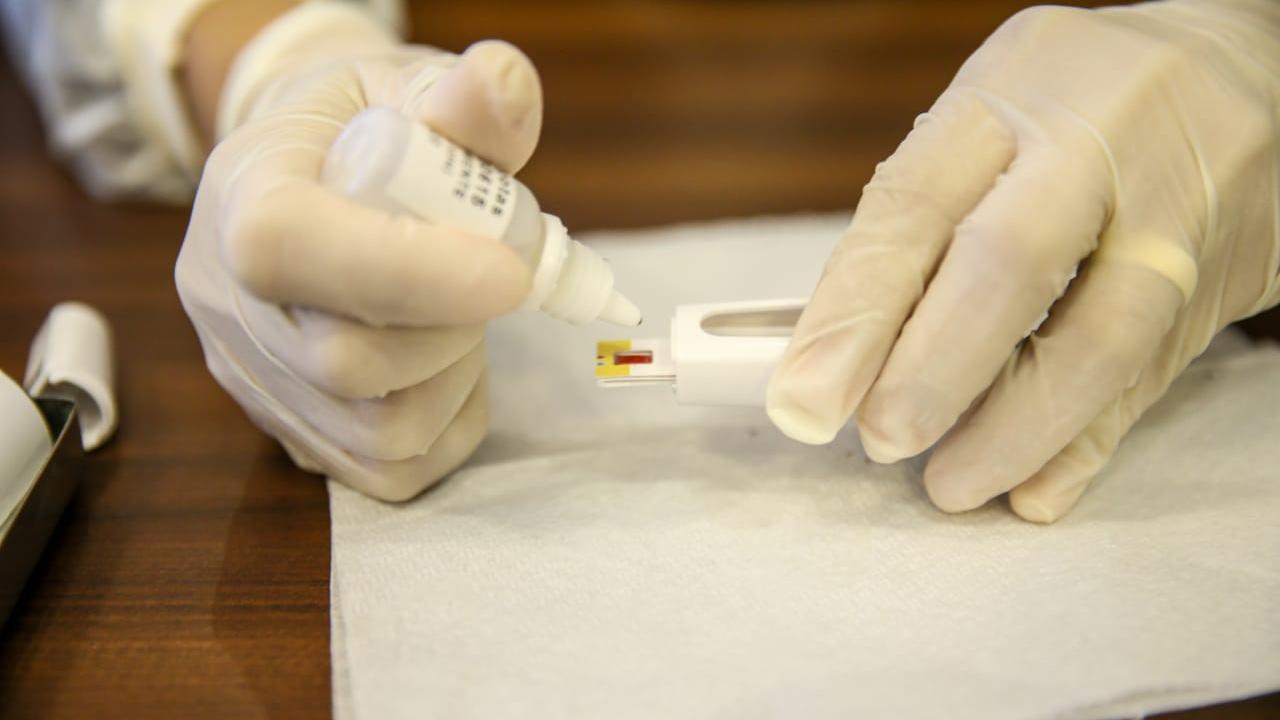 Sapezal atinge mais de mil casos de Covid-19