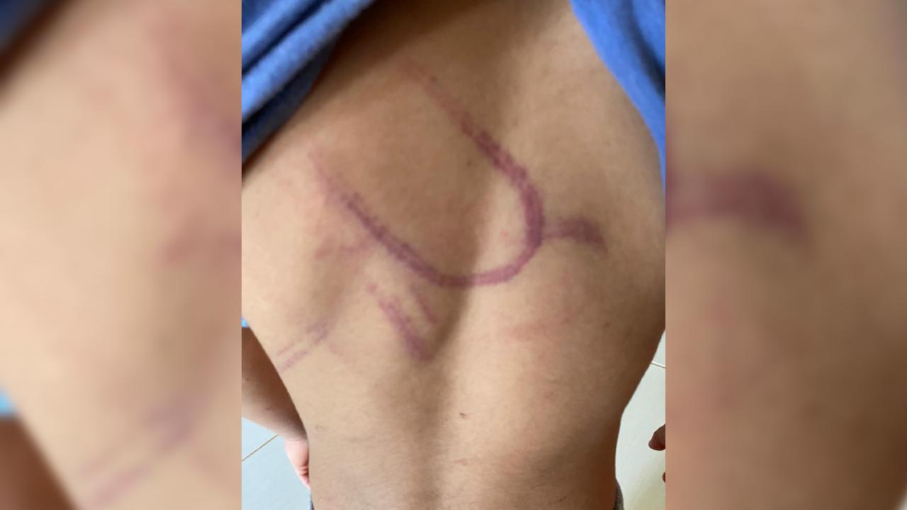 Mãe é acusada de maus-tratos contra filho pequeno em Sapezal