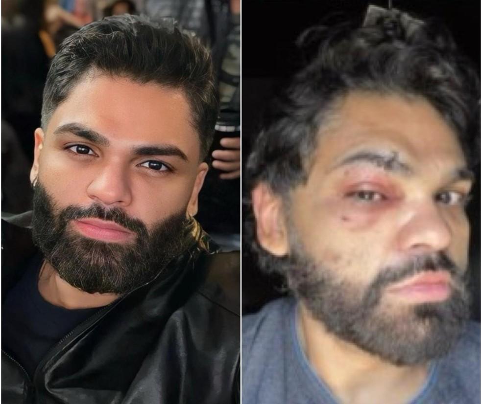 Justiça rejeita queixa-crime de psicólogo que denunciou agressão por homofobia em boate de Cuiabá